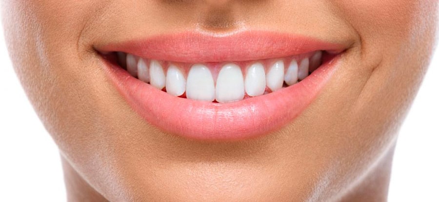 Sourire avec dents d’adulte