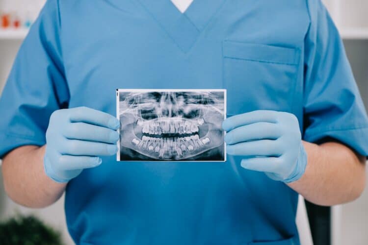 Radio des dents d'un adulte