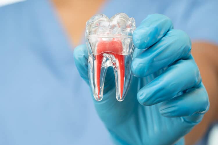 Causes et facteurs déclenchant la gingivite
