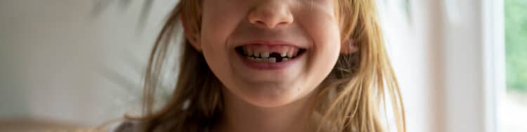 Petite fille souriante avec deux dents de lait en moins
